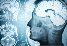 Brain & Neurosurgery Conditions